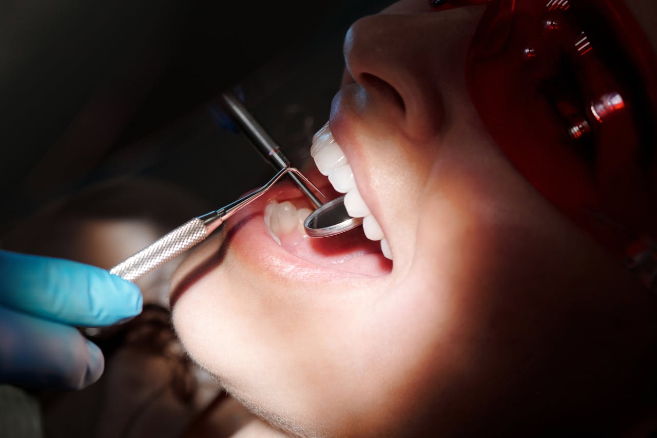 Importance of Teeth Cleaning